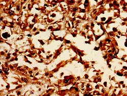 Lass5 Polyclonal Antibody:Antibodies, Polyclonal