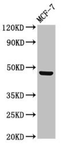 Lass5 Polyclonal Antibody:Antibodies, Polyclonal
