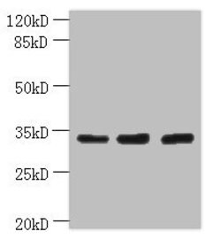 Invitrogen OTUD6B Polyclonal Antibody 100 &mu;g; Unconjugated:Antibodies,