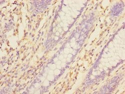 Invitrogen TXNDC5 Polyclonal Antibody 100 &mu;L; Unconjugated:Antibodies,