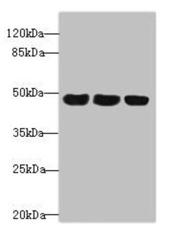 Invitrogen TXNDC5 Polyclonal Antibody 100 &mu;L; Unconjugated:Antibodies,