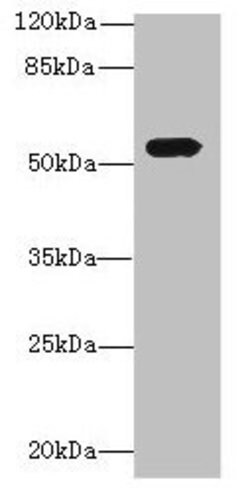 Invitrogen ICA1L Polyclonal Antibody 100 &mu;g; Unconjugated:Antibodies,