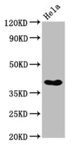 Nkx2.3 Polyclonal Antibody:Antibodies, Polyclonal