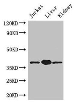 PINX1 Polyclonal Antibody:Antibodies, Polyclonal