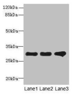 Invitrogen FAM82B Polyclonal Antibody 100 &mu;g; Unconjugated:Antibodies,