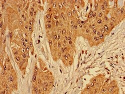 Invitrogen RPL10L Polyclonal Antibody 100 &mu;g; Unconjugated:Antibodies,