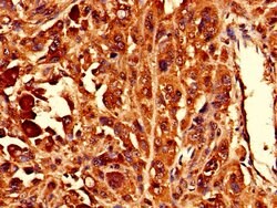 Invitrogen RPL10L Polyclonal Antibody 100 &mu;g; Unconjugated:Antibodies,