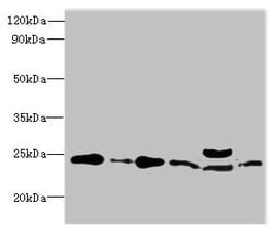 Invitrogen RPL10L Polyclonal Antibody 100 &mu;g; Unconjugated:Antibodies,