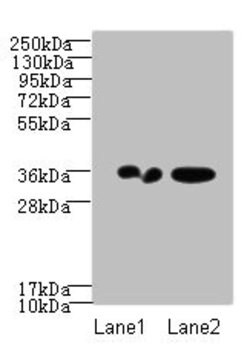 Invitrogen RPRD1A Polyclonal Antibody 100 &mu;g; Unconjugated:Antibodies,