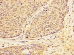 Invitrogen USP28 Polyclonal Antibody 100 &mu;L; Unconjugated:Antibodies,
