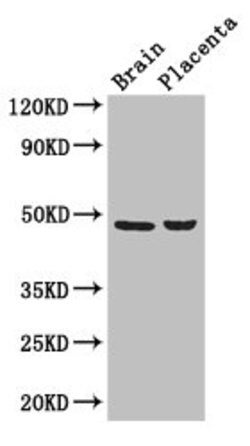 Invitrogen CD177 Polyclonal Antibody 100 &mu;g | Buy Online | Invitrogen&trade; | Fisher Scientific