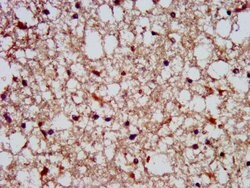 Invitrogen SLAIN1 Polyclonal Antibody 100 &mu;g; Unconjugated:Antibodies,