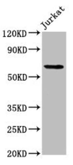 Invitrogen SLAIN1 Polyclonal Antibody 100 &mu;g; Unconjugated:Antibodies,