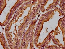 MICAL1 Polyclonal Antibody:Antibodies, Polyclonal