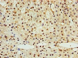 STK32A Polyclonal Antibody:Antibodies, Polyclonal