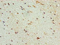 STK32A Polyclonal Antibody:Antibodies, Polyclonal