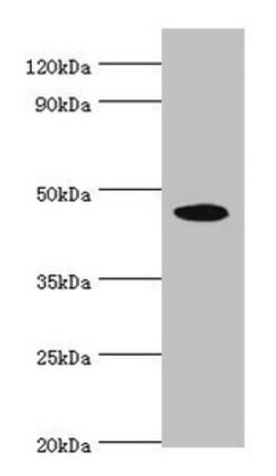 STK32A Polyclonal Antibody:Antibodies, Polyclonal