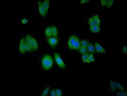 RABGGTA Polyclonal Antibody:Antibodies, Polyclonal