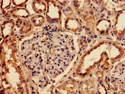 RABGGTA Polyclonal Antibody:Antibodies, Polyclonal