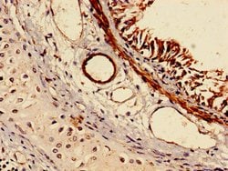 RABGGTA Polyclonal Antibody:Antibodies, Polyclonal