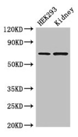 RABGGTA Polyclonal Antibody:Antibodies, Polyclonal