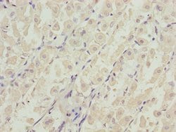Invitrogen DDX11 Polyclonal Antibody 100 &mu;L; Unconjugated:Antibodies,