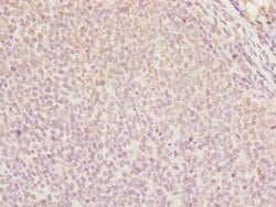 Invitrogen DDX11 Polyclonal Antibody 100 &mu;L; Unconjugated:Antibodies,