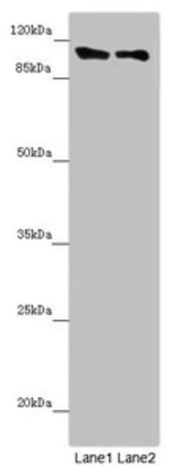 Invitrogen DDX11 Polyclonal Antibody 100 &mu;L; Unconjugated:Antibodies,