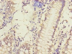 Invitrogen MCCC1 Polyclonal Antibody 100 &mu;L; Unconjugated:Antibodies,