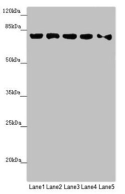 Invitrogen MCCC1 Polyclonal Antibody 100 &mu;L; Unconjugated:Antibodies,
