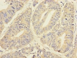 Invitrogen YME1L1 Polyclonal Antibody 100 &mu;L; Unconjugated:Antibodies,