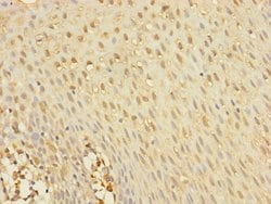 Invitrogen YME1L1 Polyclonal Antibody 100 &mu;L; Unconjugated:Antibodies,