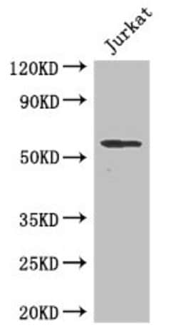 Invitrogen SPPL2A Polyclonal Antibody 100 &mu;g; Unconjugated:Antibodies,