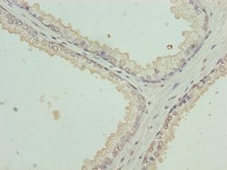 Invitrogen Cytokeratin 35 Polyclonal Antibody 100 &mu;g; Unconjugated:Antibodies,