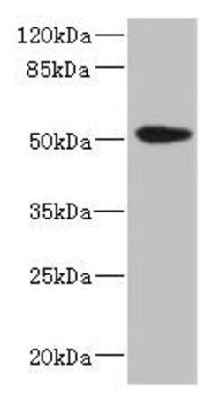 Invitrogen Cytokeratin 35 Polyclonal Antibody 100 &mu;g; Unconjugated:Antibodies,