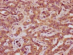Invitrogen RCN3 Polyclonal Antibody 100 &mu;g; Unconjugated:Antibodies,