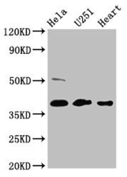 Invitrogen RCN3 Polyclonal Antibody 100 &mu;g; Unconjugated:Antibodies,