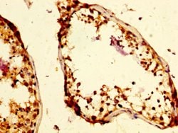 Invitrogen RAP80 Polyclonal Antibody 100 &mu;g; Unconjugated:Antibodies,