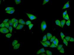 CLCC1 Polyclonal Antibody, Invitrogen 100 &mu;g; Unconjugated:Antibodies,