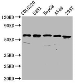 CLCC1 Polyclonal Antibody, Invitrogen 100 &mu;g; Unconjugated:Antibodies,