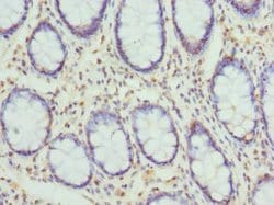 Invitrogen Cytohesin 2 Polyclonal Antibody 100 &mu;L; Unconjugated:Antibodies,
