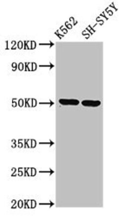 Invitrogen A33 Polyclonal Antibody 100 &mu;g; Unconjugated:Antibodies,