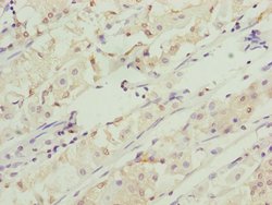 Invitrogen RNF5 Polyclonal Antibody 100 &mu;L | Buy Online | Invitrogen&trade; | Fisher Scientific