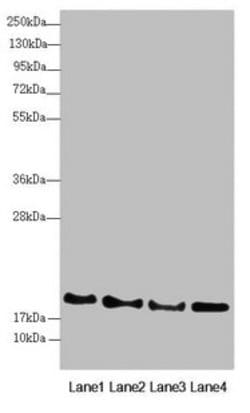 Invitrogen RNF5 Polyclonal Antibody 100 &mu;L | Buy Online | Invitrogen&trade; | Fisher Scientific