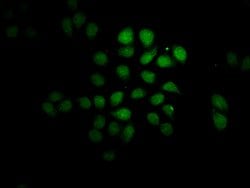 Invitrogen FEV Polyclonal Antibody 100 &mu;g; Unconjugated:Antibodies,