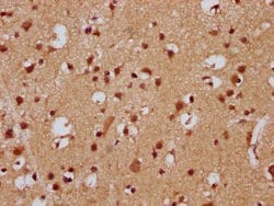 Invitrogen FEV Polyclonal Antibody 100 &mu;g; Unconjugated:Antibodies,