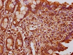Invitrogen FEV Polyclonal Antibody 100 &mu;g; Unconjugated:Antibodies,