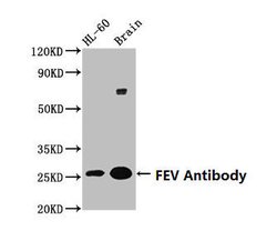 Invitrogen FEV Polyclonal Antibody 100 &mu;g; Unconjugated:Antibodies,