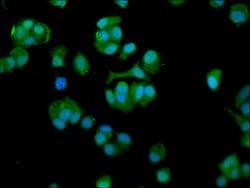Invitrogen TCP-1 eta Polyclonal Antibody 100 &mu;g; Unconjugated:Antibodies,
