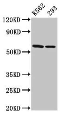 Invitrogen TCP-1 eta Polyclonal Antibody 100 &mu;g; Unconjugated:Antibodies,
